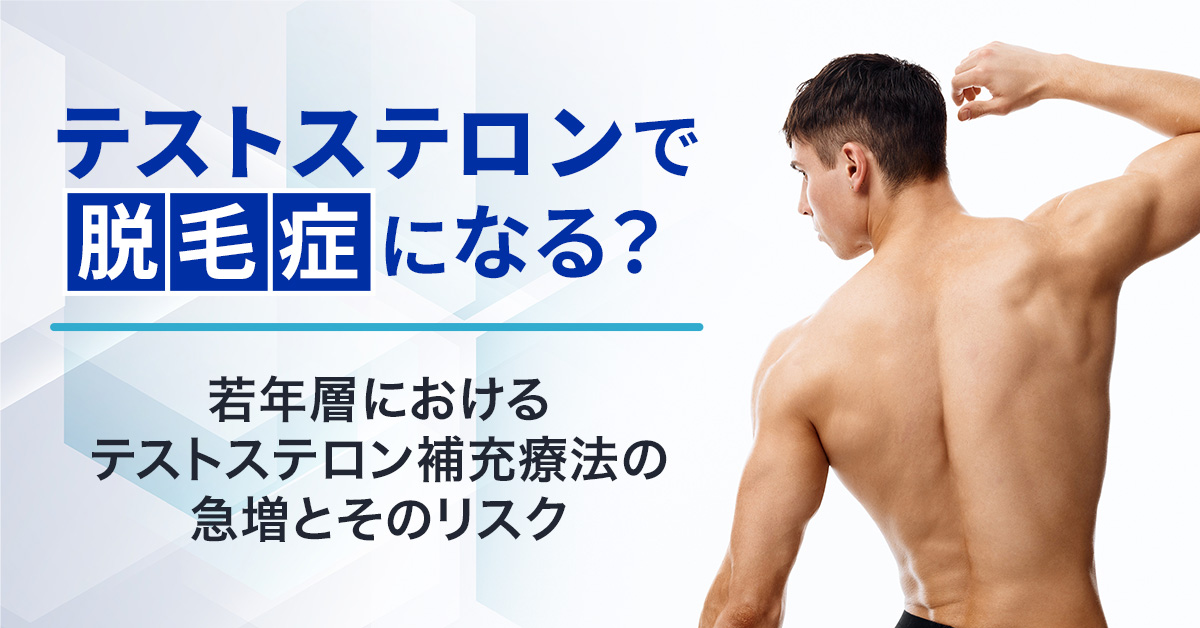 テストステロンで脱毛症になる？若年層におけるテストステロン補充療法の急増とそのリスク