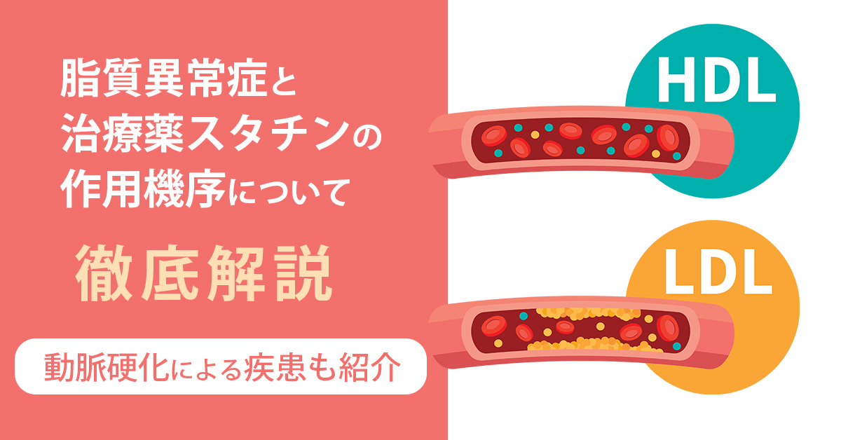 脂質異常症と治療薬スタチンの作用機序について徹底解説|動脈硬化による疾患も紹介