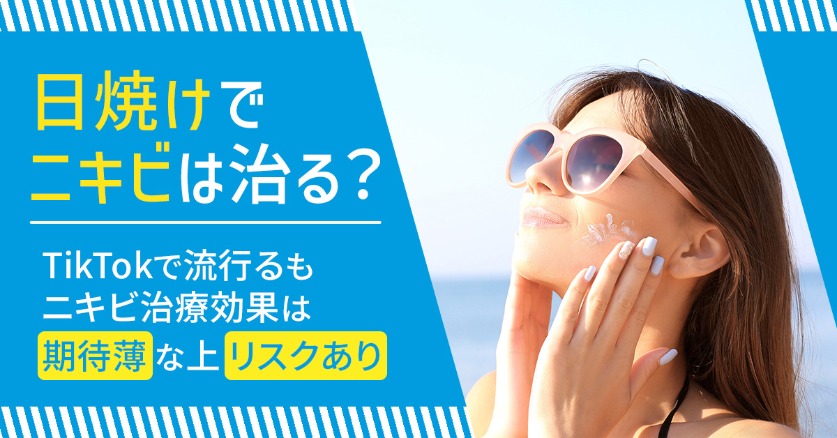 日焼けでニキビは治る？TikTokで流行るもニキビ治療効果は「期待薄」な上「リスクあり」